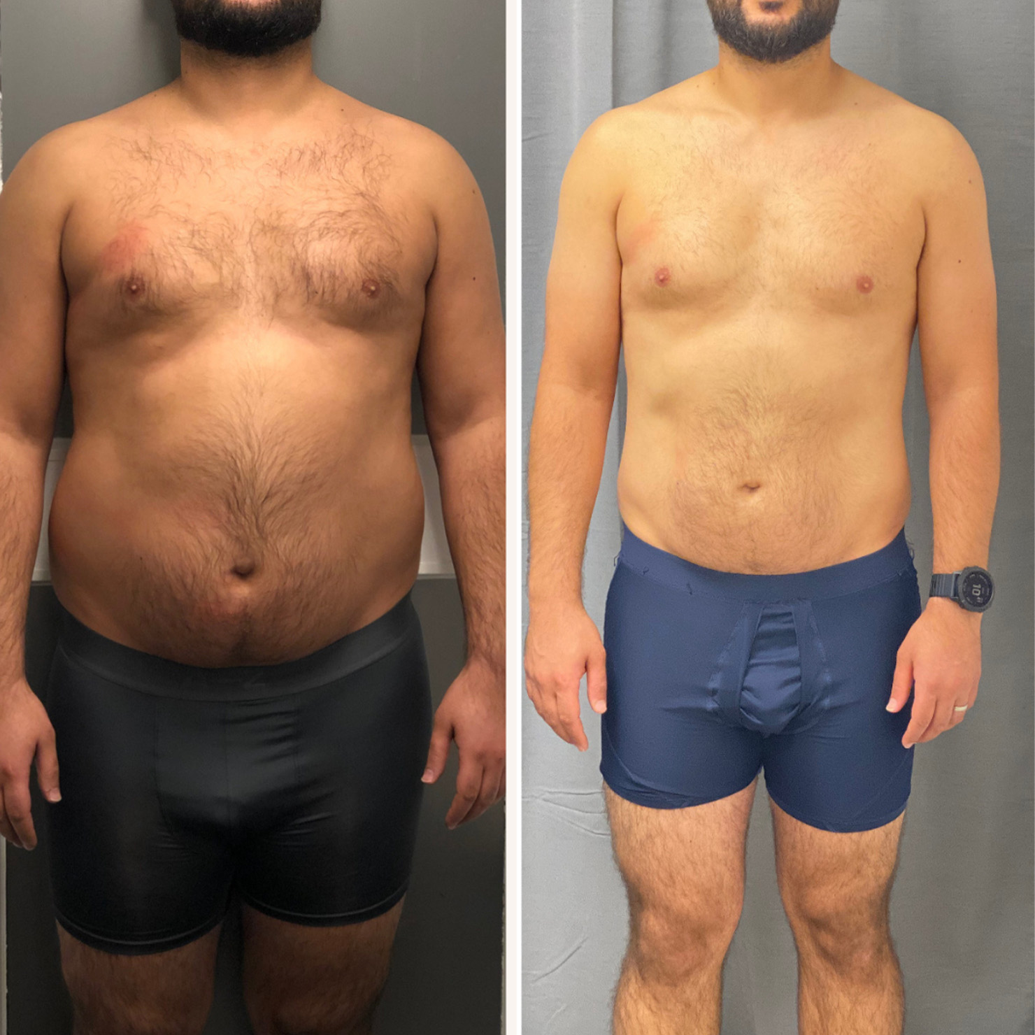 Transformation 1