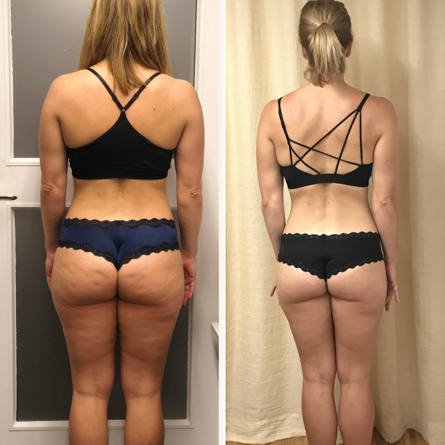 Transformation 3